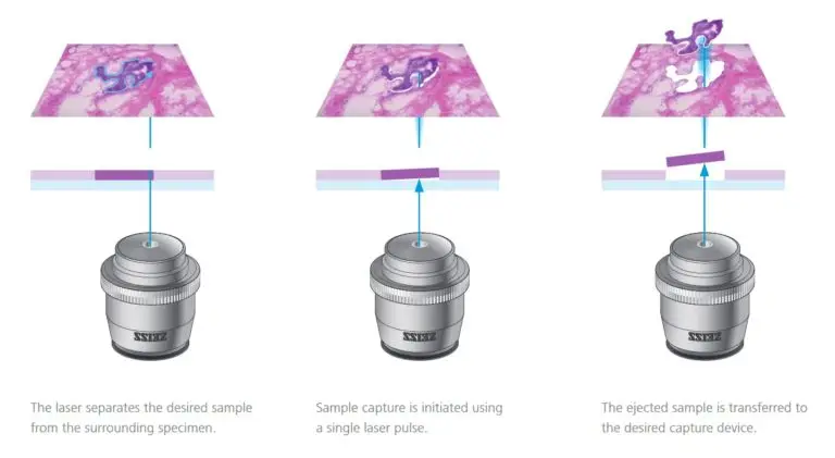 Laser capture microdissection